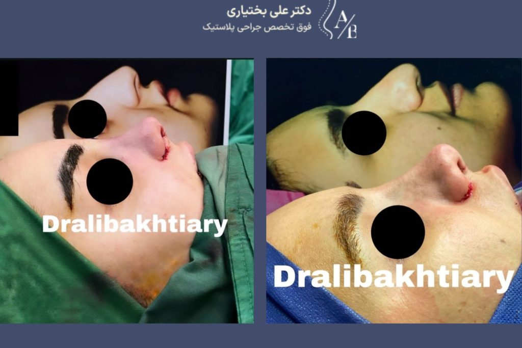 نمونه کار عمل بینی