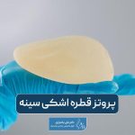 پروتز قطره اشکی سینه زنان به همراه مزایا، معایب و مراحل جراحی پروتز آناتومیک