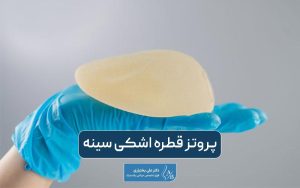 پروتز قطره اشکی سینه زنان به همراه مزایا، معایب و مراحل جراحی پروتز آناتومیک