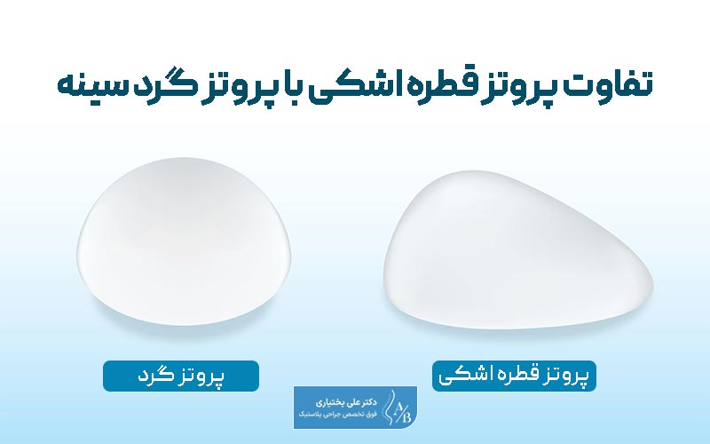 مقایسه تفاوت پروتز قطره اشکی با پروتز گرد سینه