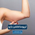 عمل جراحی لیپوساکشن بازو چیست و چه مزایایی دارد و مدت زمان بهبودی آن چقدر است؟