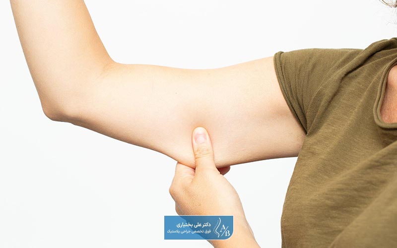 لیپوساکشن و تخلیه چربی اضافی بازو برای چه افرادی مناسب است