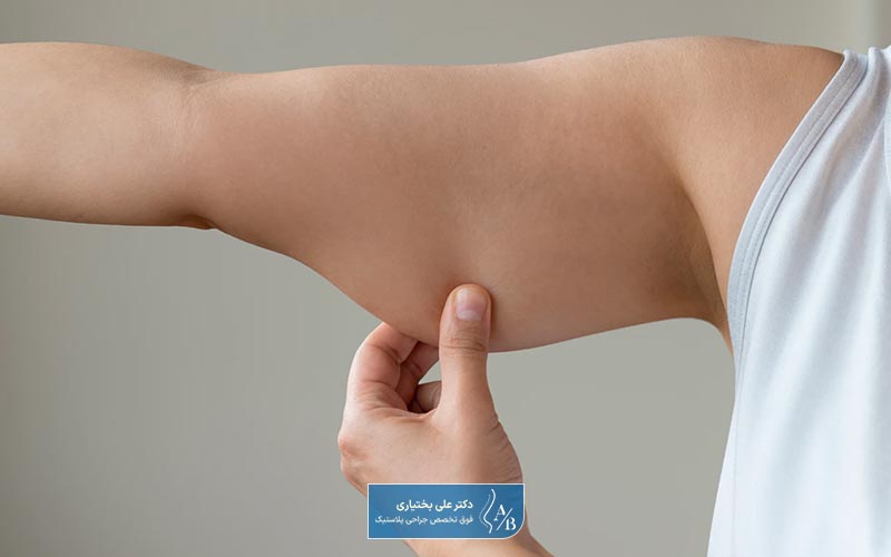 هزینه لیپوساکشن بازو چقدر است؟