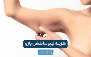 هزینه لیپوساکشن بازو در سال ۱۴۰۴ چقدر است؟ بررسی عوامل موثر بر قیمت عمل لیپو بازو در تهران