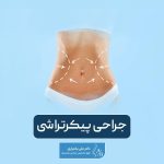 جراحی پیکرتراشی یا بادی کانتورینگ (کانتورینگ بدن) چیست و چگونه انجام میشود