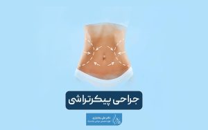 جراحی پیکرتراشی یا بادی کانتورینگ (کانتورینگ بدن) چیست و چگونه انجام میشود