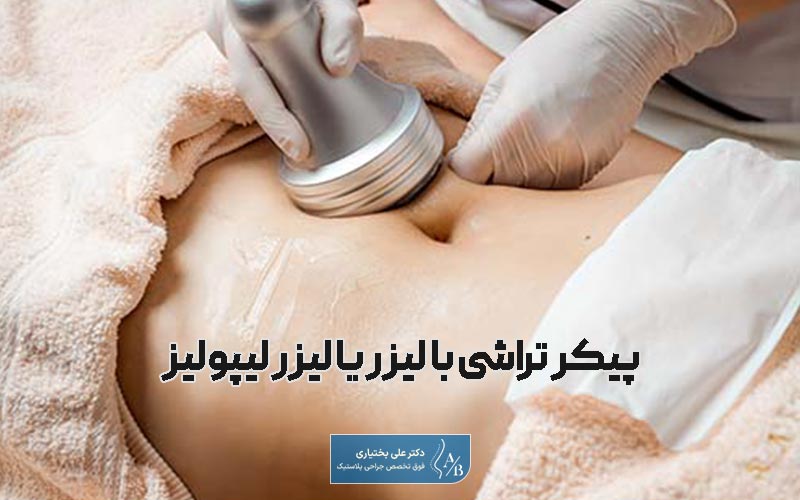 پیکرتراشی با لیزر (لیزر لیپولیز) یکی از روش های پیکرتراشی بدون عمل جراحی است