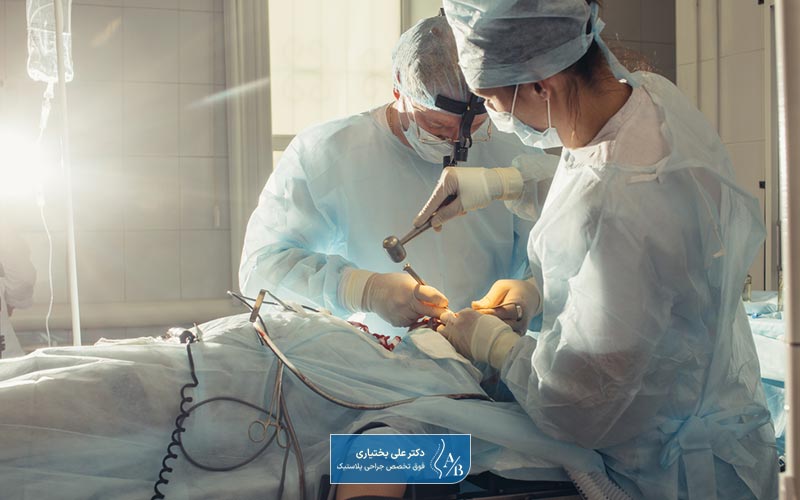 انواع مدل های جراحی بینی استخوانی و غضروفی