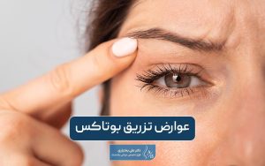 عوارض تزریق بوتاکس را بهتر بشناسید