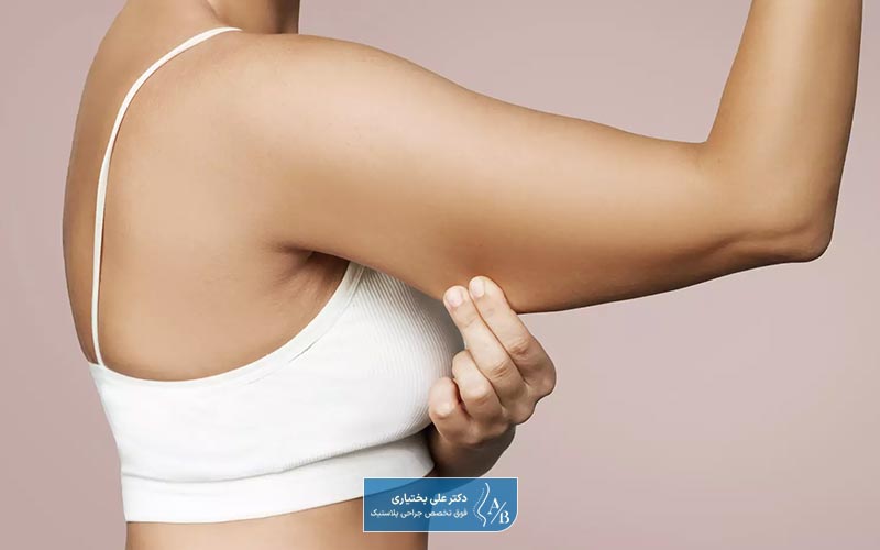 جراحی لیفت بازو یا براکیوپلاستی چیست و چه کاربردی در زیبایی بدن دارد