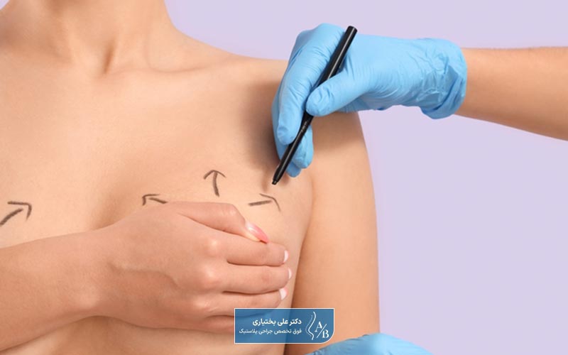 لیفت سینه چیست و چه کاربردی برای بانوان و زنان دارد