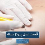 قیمت عمل پروتز سینه و عوامل موثر بر هزینه جراحی ایمپلنت پستان