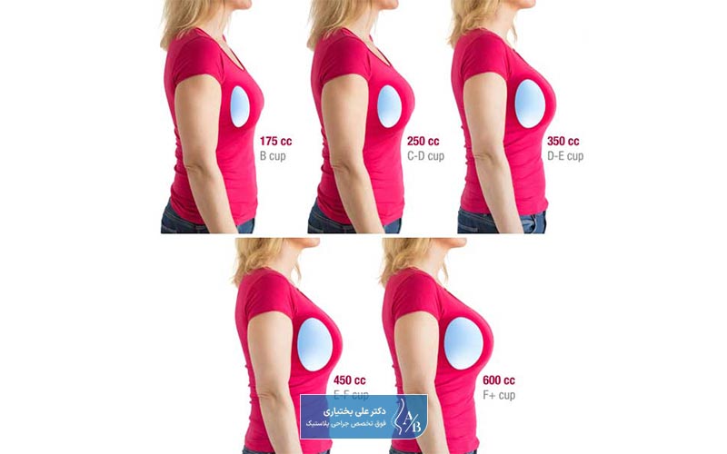 ابعاد و اندازه (سایز) پروتز سینه از عوامل موثر بر قیمت عمل جراحی پروتز سینه و پستان در زنان