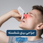 جراحی بینی شکسته و علائم آن به همراه نکات مهمی که باید بدانید
