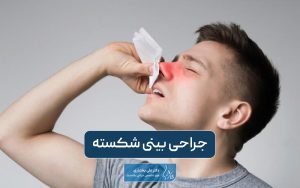 جراحی بینی شکسته و علائم آن به همراه نکات مهمی که باید بدانید