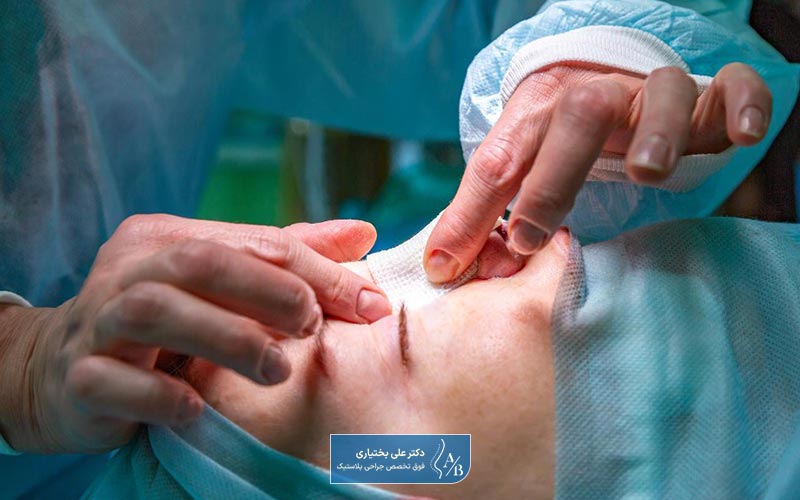 بهترین زمان جراحی بینی شکسته کی است؟
