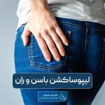 لیپوساکشن باسن و ران چیست و چگونه انجام می‌شود؟ نکات مراقبتی جراحی لاغری باسن و ران