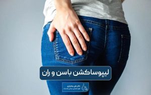 لیپوساکشن باسن و ران چیست و چگونه انجام میشود؟ نکات مراقبتی جراحی لاغری باسن و ران