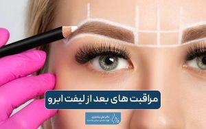 مراقبت های بعد از لیفت ابرو و نکات مهمی که باید رعایت کنید