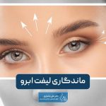 ماندگاری لیفت ابرو چقدر است؟ روش های افزایش ماندگاری در خانه