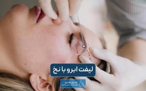 لیفت ابرو با نه چیست؟ هزینه لیفت ابرو با نخ در سال 1404 در تهران و عوامل موثر بر آن