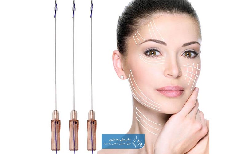 انواع نخ های لیفت ابرو جهت بالاکشیدن ابرو و جوان سازی صورت