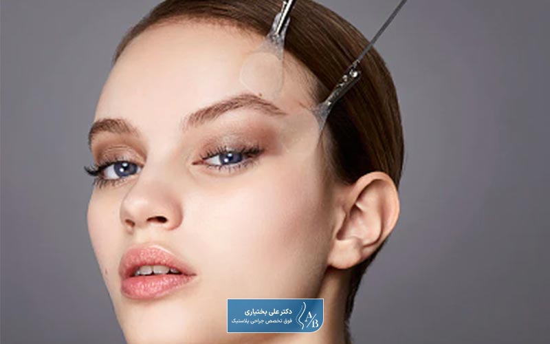 لیفت ابرو با نخ چیست و چگونه انجام می شود؟