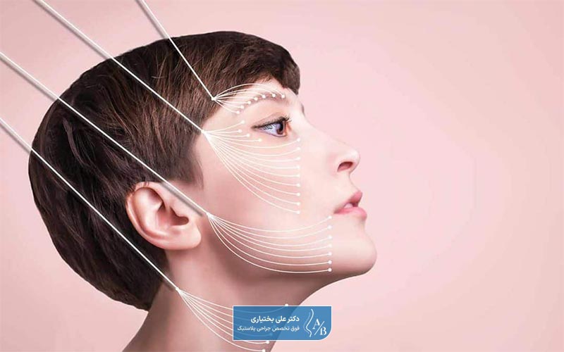لیفت صورت با نخ یکی از جدیدترین و بهترین روش های لیفت صورت بدون جراحی است