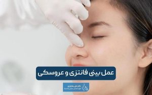 عمل بینی فانتزی و تمام مراحل جراحی بینی عروسکی در تهران