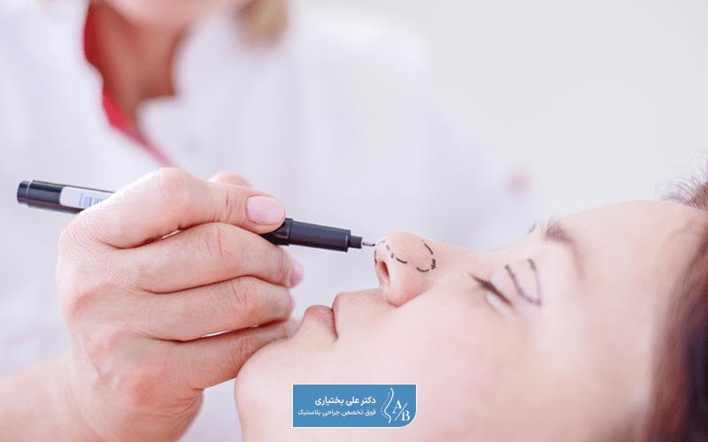 عمل بینی فانتزی عروسکی چیست و چه هدفی دارد