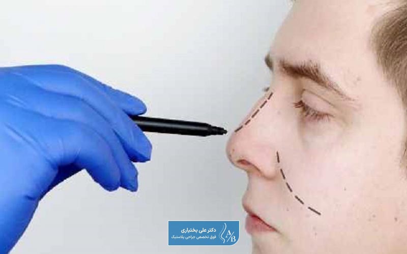 مراحل عمل جراحی بینی عروسکی و فانتزی