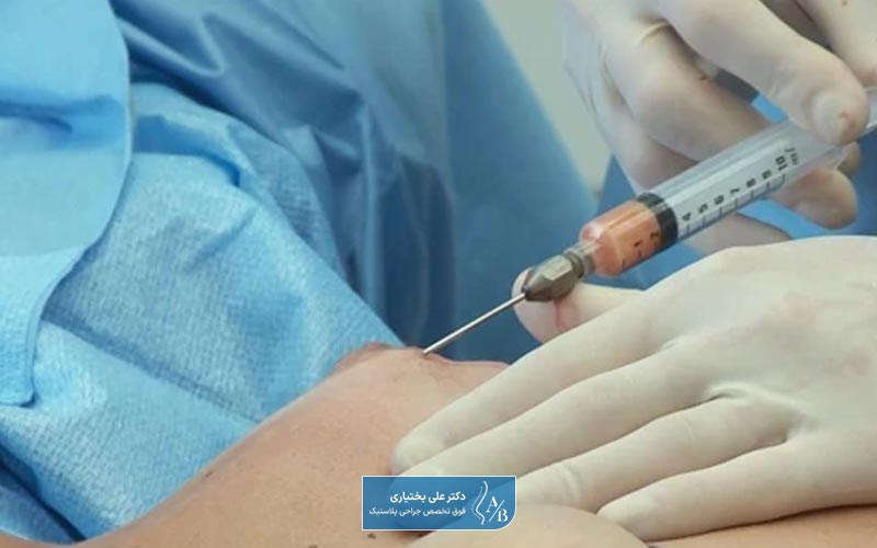 عوارض تزریق چربی به سینه و پستان در زنان چیست