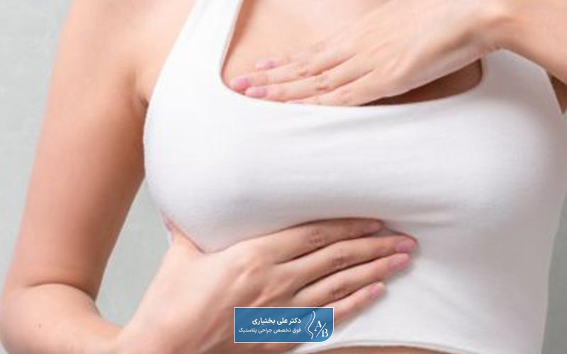 مقایسه ماموپلاستی و ماستوپکسی (لیفت سینه) در ماندگاری