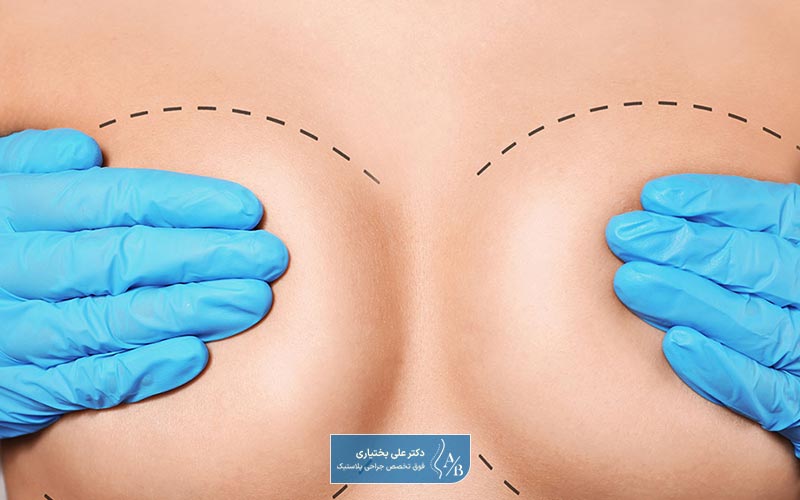 دوران نقاهت پس از جراحی لیفت و کوچک کردن سنیه در زنان به صورت همزمان چقدر است