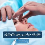 هزینه جراحی بینی گوشتی و پهن در تهران سال ۱۴۰۴ چقدر است؟