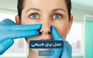 عمل بینی طبیعی و نچرال و نحوه انجام آن برای مردان و زنان