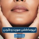 لیپوساکشن صورت و گردن و بررسی مراحل جراحی آن