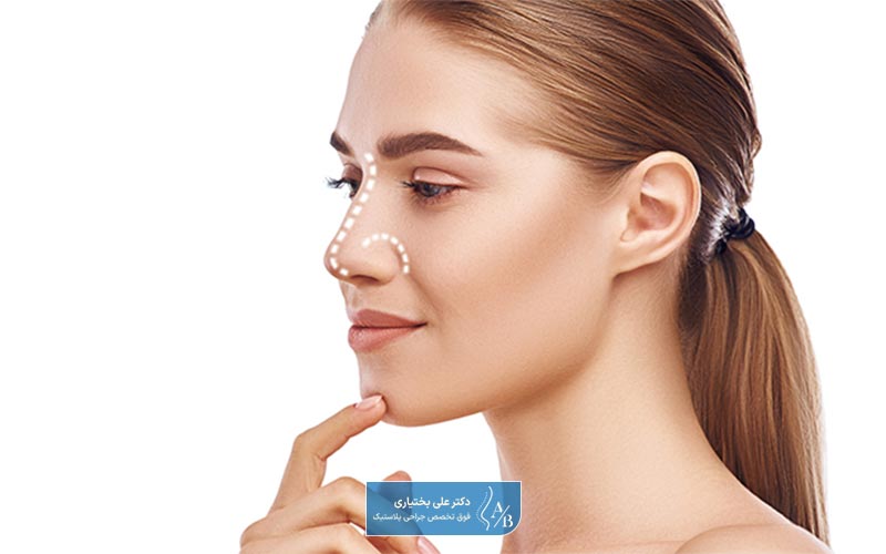 مشکلاتی که منجر به انجام عمل جراحی ترمیمی بینی میشود کدام است