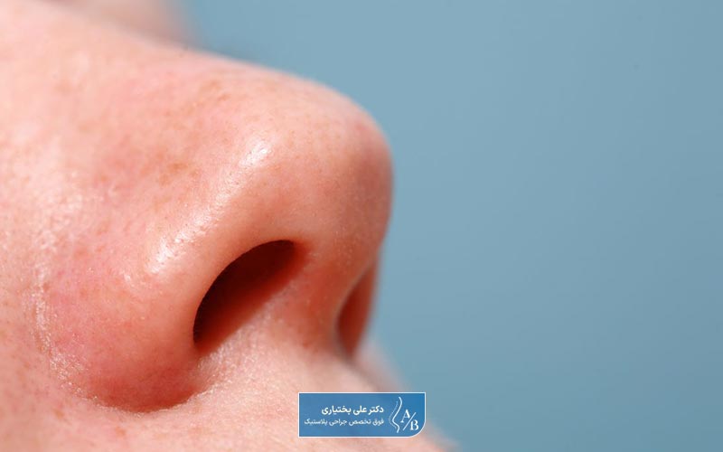 تفاوت های جراحی ترمیمی بینی با عمل اولیه بینی در چیست