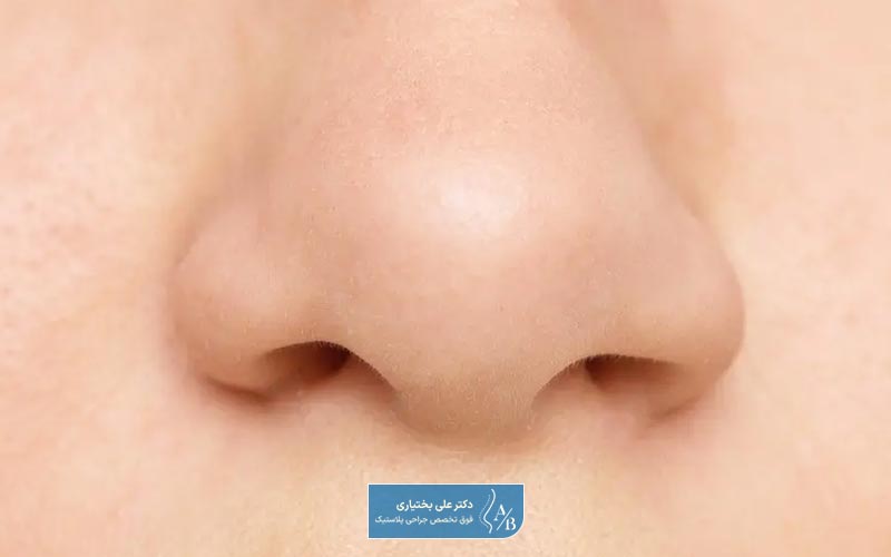 مراقبت های بعد از عمل ترمیمی بینی و نکات مهم آن