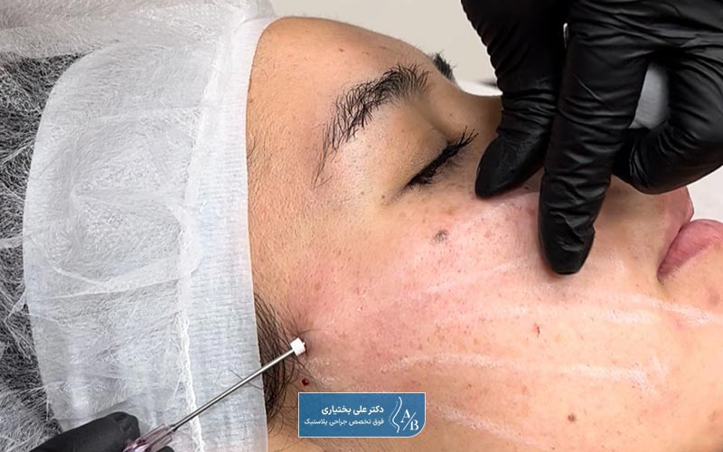 نخ PDO چیست و چه کاربردی دارد