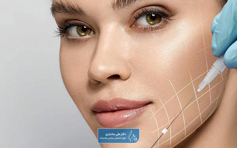 ماندگاری نخ لیفت صورت PDO چقدر است؟