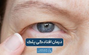 درمان افتادگی پلک و روش های رفع آن در خانه و با جراحی و بدون جراحی