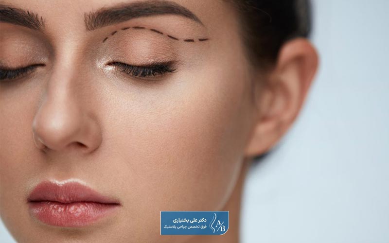 روش های درمان خانگی افتادگی پلک و پتوز