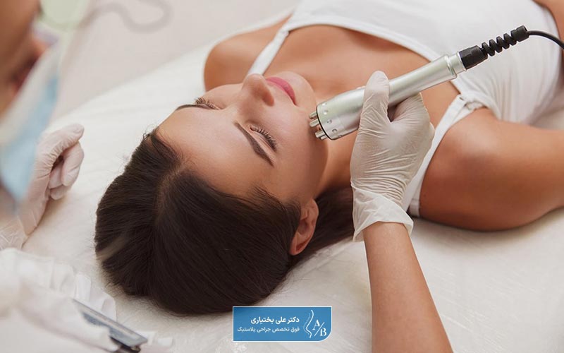 رفع جای جوش صورت با استفاده از دستگاه امواج رادیویی RF