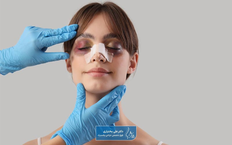 روزهای ابتدایی پس از جراحی بینی چه نکاتی را باید رعایت کنیم