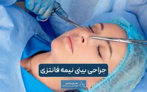 جراحی بینی نیمه فانتزی و بررسی نکات مهم آن به همراه هزینه عمل بینی نیمه عروسکی در تهران در سال 1404