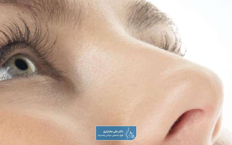 هزینه عمل بینی نیمه فانتزی و نیمه عروسکی در سال 1404 در تهران چقدر است؟