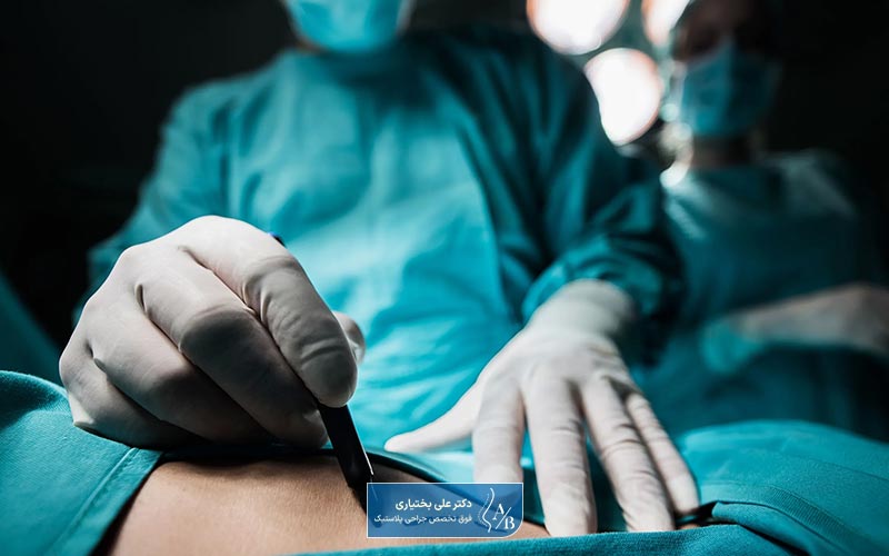 عمل همزمان لیفت و پروتز سینه چیست و چه کاربردی دارد