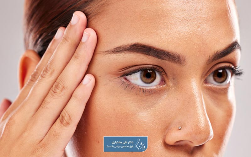 مراقبت های بعد از لیفت شقیقه به همراه بررسی هزینه های جانبی آن